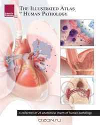 The Illustrated Atlas of Human Pathology