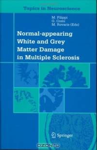 Normal-appearing White and Grey Matter Damage in Multiple Sclerosis (Topics in Neuroscience)