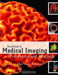 Handbook of Medical Imaging