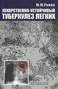 Лекарственно-устойчивый туберкулез легких
