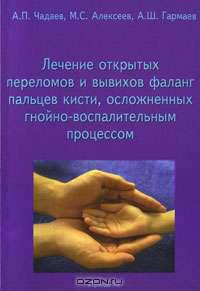 Лечение открытых переломов и вывихов фаланг пальцев кисти, осложненных гнойно-воспалительным процессом.