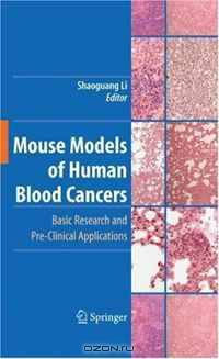 Mouse Models of Human Blood Cancers: Basic Research and Pre-clinical Applications