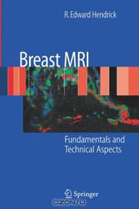 Breast MRI: Fundamentals and Technical Aspects