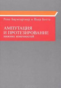 Ампутация и протезирование нижних конечностей