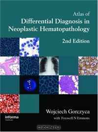 Atlas of Differential Diagnosis in Neoplastic Hematopathology, Second Edition