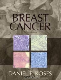 Breast Cancer
