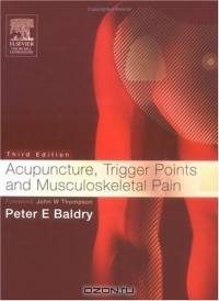 Acupuncture, Trigger Points and Musculoskeletal Pain