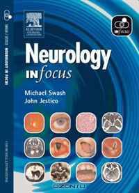 Neurology In Focus