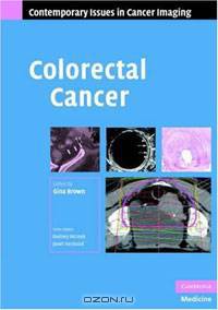 Colorectal Cancer