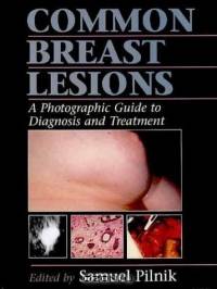 Common Breast Lesions : A Photographic Guide to Diagnosis and Treatment