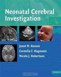 Neonatal Cerebral Investigation