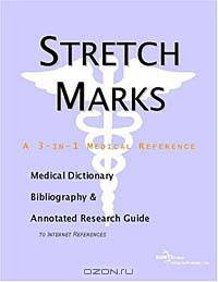 Stretch Marks - A Medical Dictionary, Bibliography, and Annotated Research Guide to Internet Referen