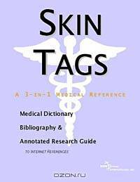 Skin Tags - A Medical Dictionary, Bibliography, and Annotated Research Guide to Internet References