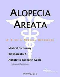 Alopecia Areata - A Medical Dictionary, Bibliography, and Annotated Research Guide to Internet Refer