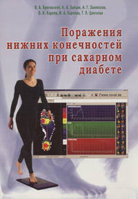 Поражения нижних конечностей при сахарном диабете