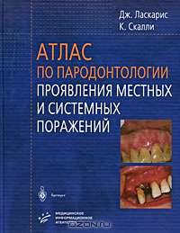 Атлас по пародонтологии