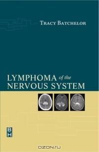 Lymphoma of the Nervous System