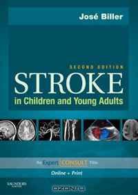 Stroke in Children and Young Adults: Expert Consult - Online and Print