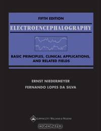 Electroencephalography: Basic Principles, Clinical Applications, and Related Fields