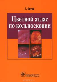 Цветной атлас по кольпоскопии
