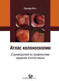 Атлас колоноскопии с руководством по профилактике карцином толстой кишки