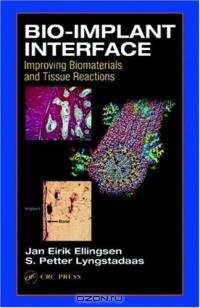 Bio-Implant Interface: Improving Biomaterials and Tissue Reactions