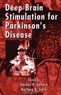 Deep Brain Stimulation for Parkinson