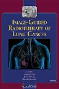 Image-Guided Radiotherapy of Lung Cancer