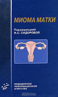 Миома матки (современные проблемы этиологии, патогенеза, диагностики и лечения)