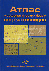 Атлас морфологических форм сперматозоидов.