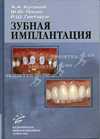 Зубная имплантация: основные принципы, современные достижения