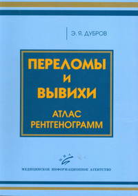 Переломы и вывихи. Атлас рентгенограмм