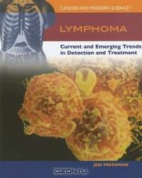 Lymphoma: Current And Emerging Trends in Detection And Treatment (Cancer and Modern Science)