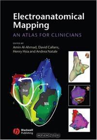 Electroanatomical Mapping: An Atlas for Clinician