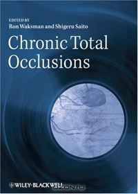 Chronic Total Occlusions