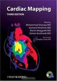 Cardiac Mapping