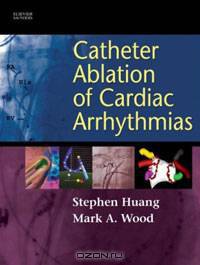 Catheter Ablation of Cardiac Arrhythmias