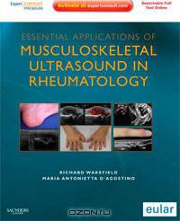 Essential Applications of Musculoskeletal Ultrasound in Rheumatology: Expert Consult Premium Edition: Enhanced Online Features and Print