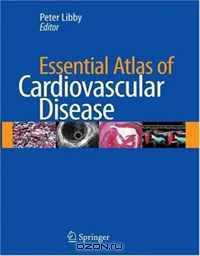 Essential Atlas of Cardiovascular Disease