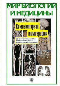 Компьютерная томография: Основы, техника, качество изображений и области клинического использования. /Пер. с англ.(Серия:'Мир биологии и медицины')