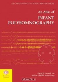 An Atlas of Infant Polysomnography (The Encyclopedia of Visual Medicine Series)