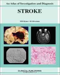 Stroke: An Atlas of Investigation and Diagnosis (Atlases of Investigation and Management)