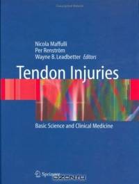 Tendon Injuries