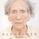 Alzheimer, Christoph Ribbat 