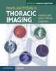 Pearls and Pitfalls in Thoracic Imaging: Variants and Other Difficult Diagnoses, Thomas Hartman 