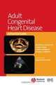 Adult Congenital Heart Disease, Michael A. Gatzoulis 
