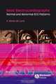 Basic Electrocardiography, Antoni Bayes de Luna 