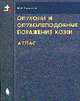Опухоли и опухолеподобные поражения кожи. Атлас, Ламоткин И.А. 