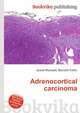 Adrenocortical carcinoma, Jesse Russell,Ronald Cohn 