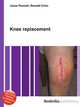 Knee replacement, Jesse Russell,Ronald Cohn 